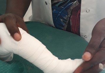 Madagascar Clubfoot Clinics Continue to Care for Children