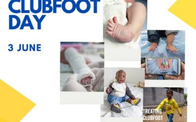 World Clubfoot Day, 3 June!